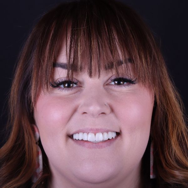 Close-up of a smiling woman with brown hair and bangs, showing straight, white teeth