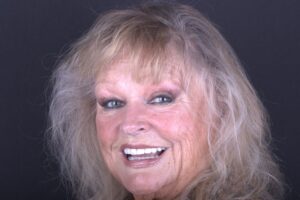 female dental patient with restored smile